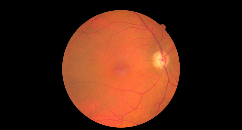 Fundus
