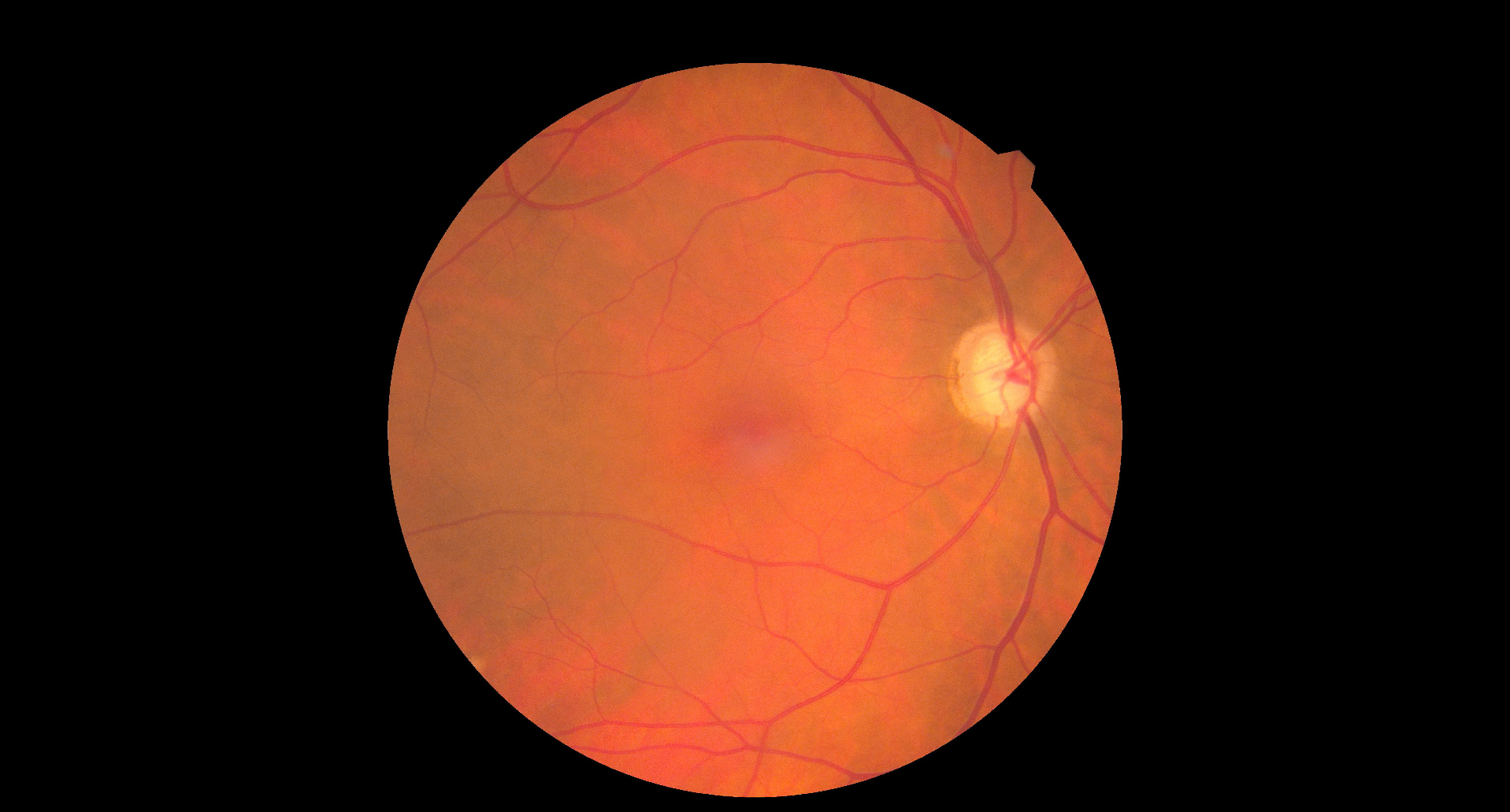 Fundus